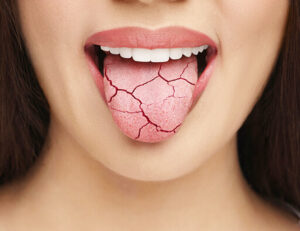 秋葉原の歯医者、スマイルデザインデンタルクリニック秋葉原で、ガルバニー電流について解説