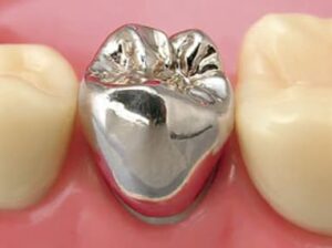 秋葉原の歯医者、スマイルデザインデンタルクリニック秋葉原で、痛みがなかった歯が治療後に痛くなったのはなぜ？原因や対処法を解説