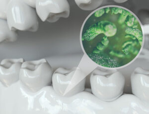 秋葉原の歯医者、スマイルデザインデンタルクリニック秋葉原で、大人の矯正歯科について解説