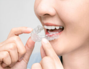 秋葉原の歯医者、スマイルデザインデンタルクリニック秋葉原で、大人の矯正歯科について解説