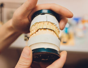 秋葉原の歯医者、スマイルデザインデンタルクリニック秋葉原で、咬合性外傷を解説