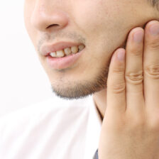 秋葉原の歯医者、スマイルデザインデンタルクリニック秋葉原で、咬合性外傷を解説