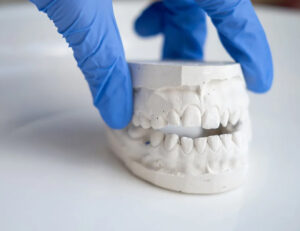 秋葉原の歯医者、スマイルデザインデンタルクリニック秋葉原で、咬合性外傷を解説