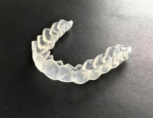 秋葉原の歯医者、スマイルデザインデンタルクリニック秋葉原で、咬合性外傷を解説