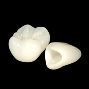 秋葉原の歯医者、スマイルデザインデンタルクリニック秋葉原で、セラミック矯正の削る量について解説