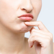 秋葉原の歯医者、スマイルデザインデンタルクリニック秋葉原で、矯正治療で口元が下がる原因や対処法について解説