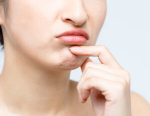 秋葉原の歯医者、スマイルデザインデンタルクリニック秋葉原で、矯正治療で口元が下がる原因や対処法について解説