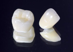 秋葉原の歯医者、スマイルデザインデンタルクリニック秋葉原で、セラミック矯正の削る量について解説