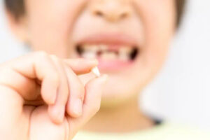 秋葉原の歯医者、スマイルデザインデンタルクリニック秋葉原で、八重歯について解説