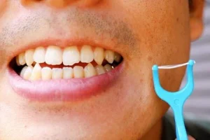 秋葉原の歯医者、スマイルデザインデンタルクリニック秋葉原で、隣接面カリエスについて解説