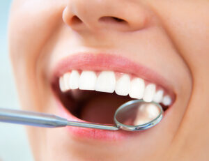 秋葉原の歯医者、スマイルデザインデンタルクリニック秋葉原で、隣接面カリエスについて解説