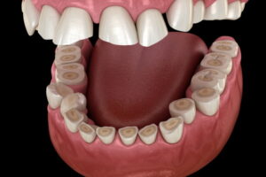 秋葉原の歯医者、スマイルデザインデンタルクリニック秋葉原で、デスクワーカーに多い「噛みしめ症候群」の症状と対処法を解説