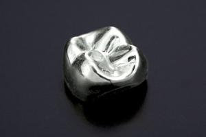 秋葉原の歯医者、スマイルデザインデンタルクリニック秋葉原で、歯の詰め物が取れやすい人の原因と予防策を解説