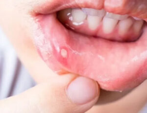 秋葉原の歯医者、スマイルデザインデンタルクリニック秋葉原で、声優・アナウンサーのオーラルケア方法と発声に影響する歯並びの関係を解説