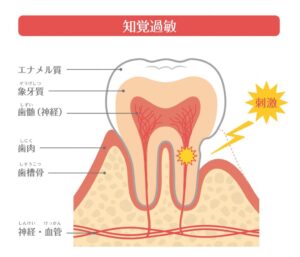 秋葉原の歯医者、スマイルデザインデンタルクリニック秋葉原で、デスクワーカーに多い「噛みしめ症候群」の症状と対処法を解説