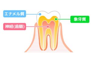 秋葉原の歯医者、スマイルデザインデンタルクリニック秋葉原で、「酸っぱいものがしみる」のは歯が溶けているサイン？酸蝕症のリスクについて解説