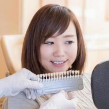 秋葉原の歯医者、スマイルデザインデンタルクリニック秋葉原で、詰め物がある歯はホワイトニングできない？白さのムラを防ぎ、理想の笑顔を手に入れる手法について解説